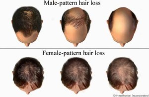 And hair growth progesterone PROGESTERONE CREAM