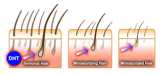Hair Loss in Men and Women: Diagnosis and Treatment Options - CareFirst Specialty Pharmacy's Blog Hair Loss in Men and Women: Diagnosis and Treatment Options - CareFirst Specialty Pharmacy's Blog