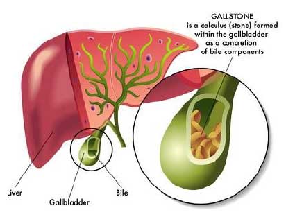 Ursodiol Image 2